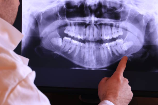Best Mobile Emergency Dentist in Lowry Crossing, TX