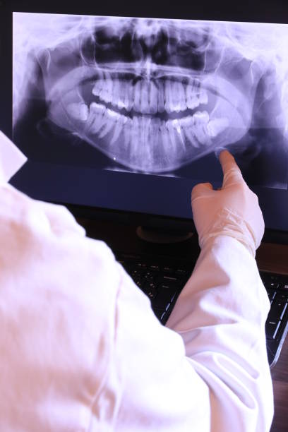 Best Emergency Dentist for Knocked-Out Tooth in Lowry Crossing, TX